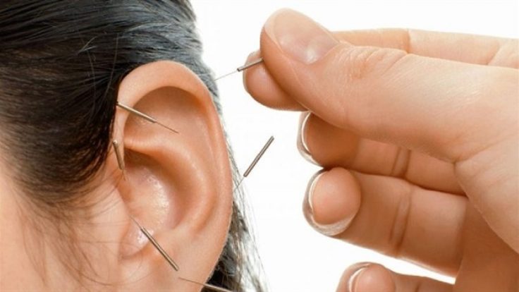 Akupunktur ve sibernetik etki